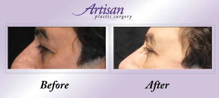 artisan plastic surgery