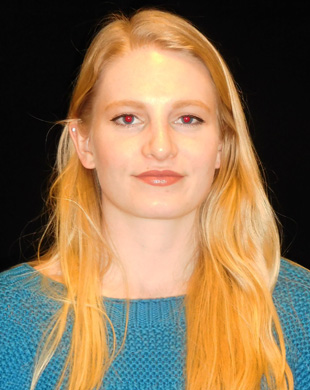 Case--4362 | After Rhinoplasty