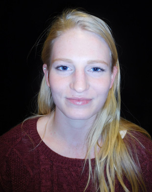 Case--4362 | Before Rhinoplasty