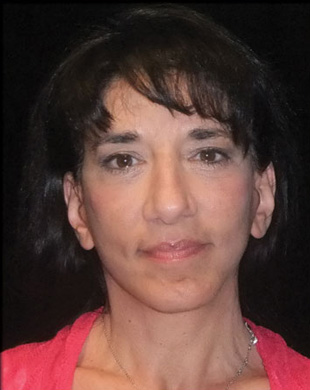 Case--5415 | After Mini Facelift