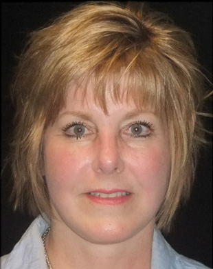 Case--9325 | After Mini Facelift